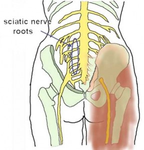sciatic_nerve-roots